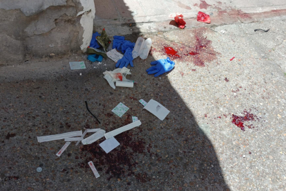 Sangre del herido a machetazos en la calle Sinagoga de Valladolid