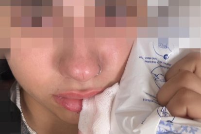 heridas provocadas por una agresión homófoba en Valladolid