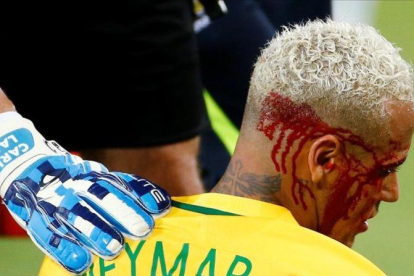 Neymar, tras recibir el codazo ante Bolivia.-REUTERS / RICARDO MORAES