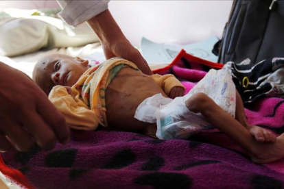Un niño que sufre de desnutrición recibe tratamiento en un hospital de Saná, el 24 de noviembre.-/ EFE / YAHYA ARHAB