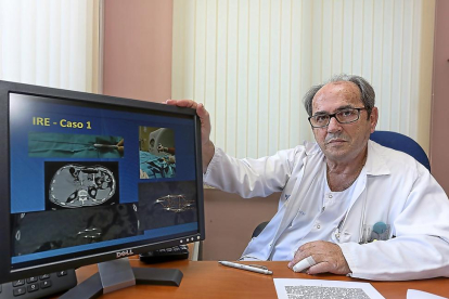 El radiólogo Javier Trueba en las instalaciones del Hospital Clínico Universitario de Valladolid.-MIGUEL ÁNGEL SANTOS