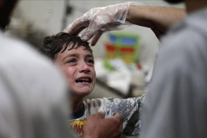 Un niño sirio herido en un bombardeo del Gobierno el pasado martes.-Foto: AFP / ABD DOUMANY