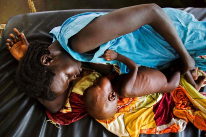 Una mujer intenta amamantar a su hijo, con síntomas de malnutrición, en Sudán del Sur.-ALBERT GONZÁLEZ FARRAN