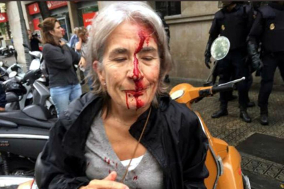 Una mujer con el rostro ensangrentado por las cargas policiales del 1-O-ACN