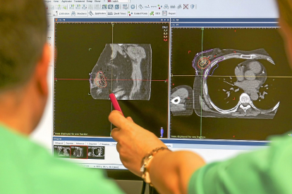 Imagen de un tumor de mama dectectado en el Hospital Clínico de Valladolid. PHOTOGENIC