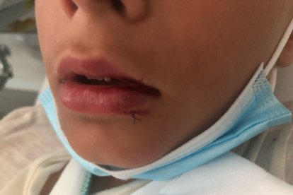 Lesiones tras la caída en el patio del colegio público de Tudela.