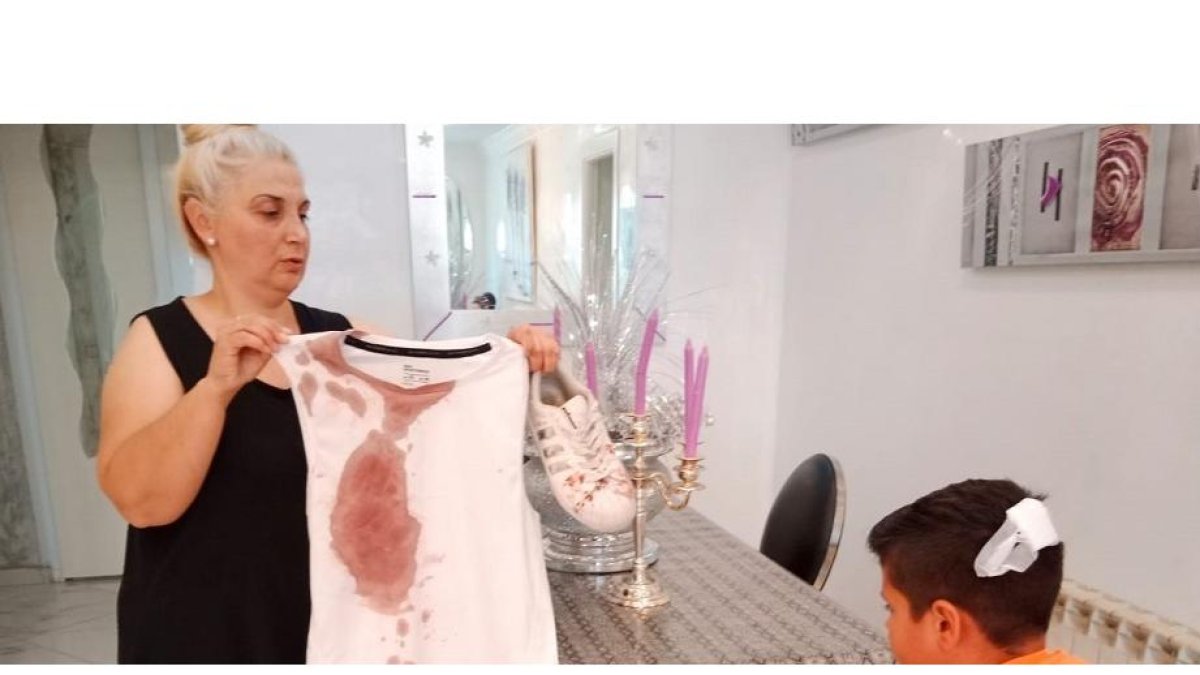La abuela muestra la camiseta ensangrentada del niño, que tiene un brecha en la cabeza. E. M.