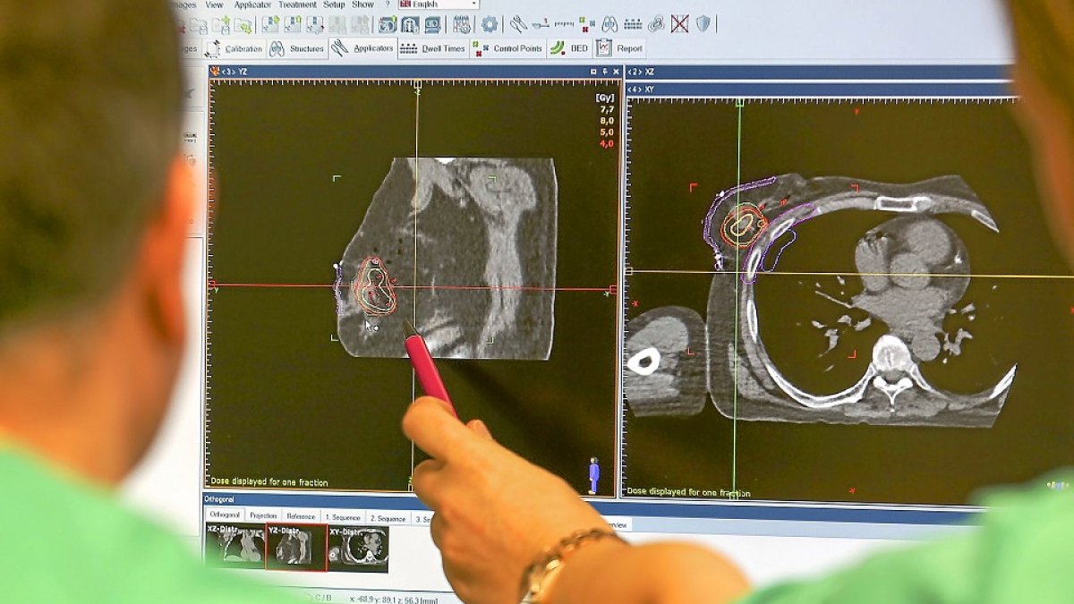 Imagen de un tumor de mama dectectado en el Hospital Clínico de Valladolid. PHOTOGENIC