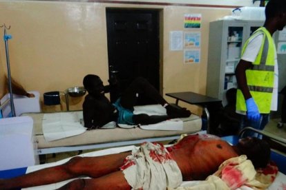 Una víctima de un ataque suicida yace en una cama de hospital esperando a ser atendida, en Maiduguri (nordeste de Nigeria), el 15 de agosto-AFP