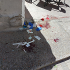 Sangre del herido a machetazos en la calle Sinagoga de Valladolid