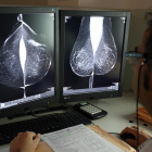 Servicio de mamografía en el hospital Río Hortega de Valladolid, en una imagen de archivo. -ICAL