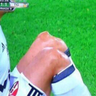 Óscar Ustari, tras lesionarse-TWITTER