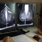 Estudio una mamografía digital, en el servicio de mamografías del Hospital Río Hortega de Valladolid.-ICAL