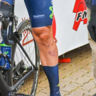 Las cicatrices de Fran Ventoso en la pierna izquierda.-TWITTER @RUEDALENTICULAR