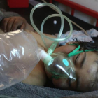 Un niño sirio recibe tratamiento tras el ataque con gass tóxico-AFP