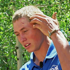 Dylan, el joven de 19 años que ha sobrevivido al ataque de un oso en Colorado (EEUU).-AP