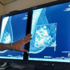 Un radiólogo compara dos mamografías para detectar tumores.