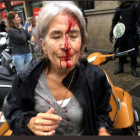 Una mujer con el rostro ensangrentado por las cargas policiales del 1-O-ACN