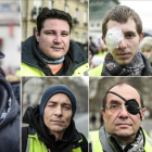 Algunos de los manifestantes chalecos amarillos que acusan a la policía francesa de sus heridas.-FRANCE PRESS