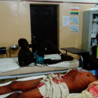 Una víctima de un ataque suicida yace en una cama de hospital esperando a ser atendida, en Maiduguri (nordeste de Nigeria), el 15 de agosto-AFP