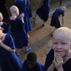 Centro donde se aloja y protege a niños albinos en Tanzania.-Foto: AFP / TONY KARUMBA