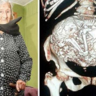 Al hacerle una radiografía a Estela, apareció una imagen que es propia de la columna vertebral de un feto.-Foto:   EL LÍDER DE SAN ANTONIO