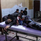 Un herido en un bombardeo en Guta es atendido en un hospital de Duma.-EFE / MOHAMMED BADRA