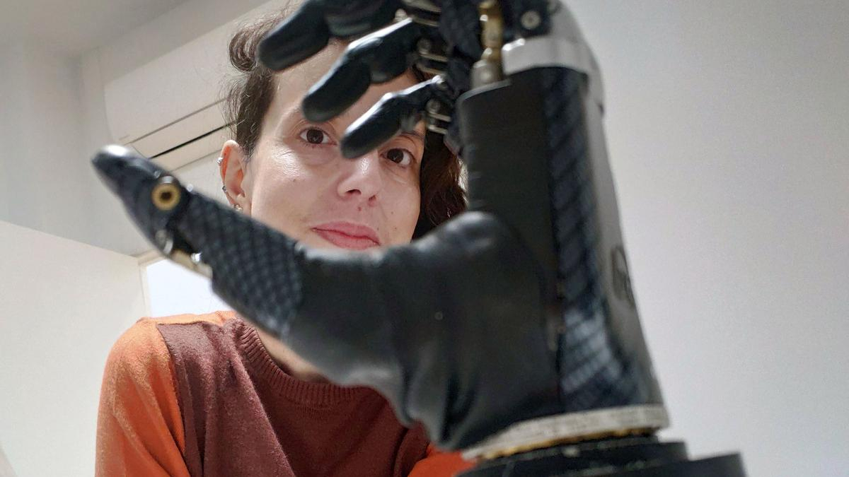 Rut Carpintero, vallisoletana de 43 años que en el pasado mes de abril tuvieron que amputarle las cuatro extremidades