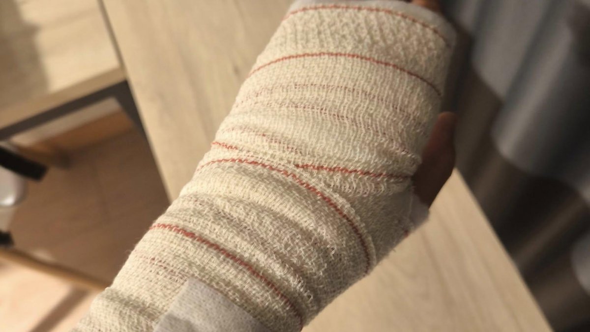 Mano vendada del seguidor del Ceuta que requiere asistencia médica en Zorrilla.