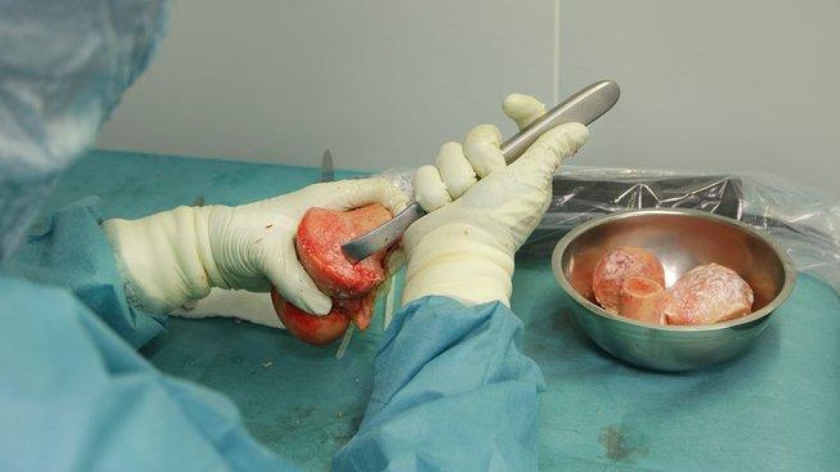 Según estimaciones de la Oficina Regional de las Naciones Unidas contra la Droga y el Delito (UNODC), la modalidad de tráfico de órganos representa una cifra aproximada de 600 millones de dólares a nivel mundial.-