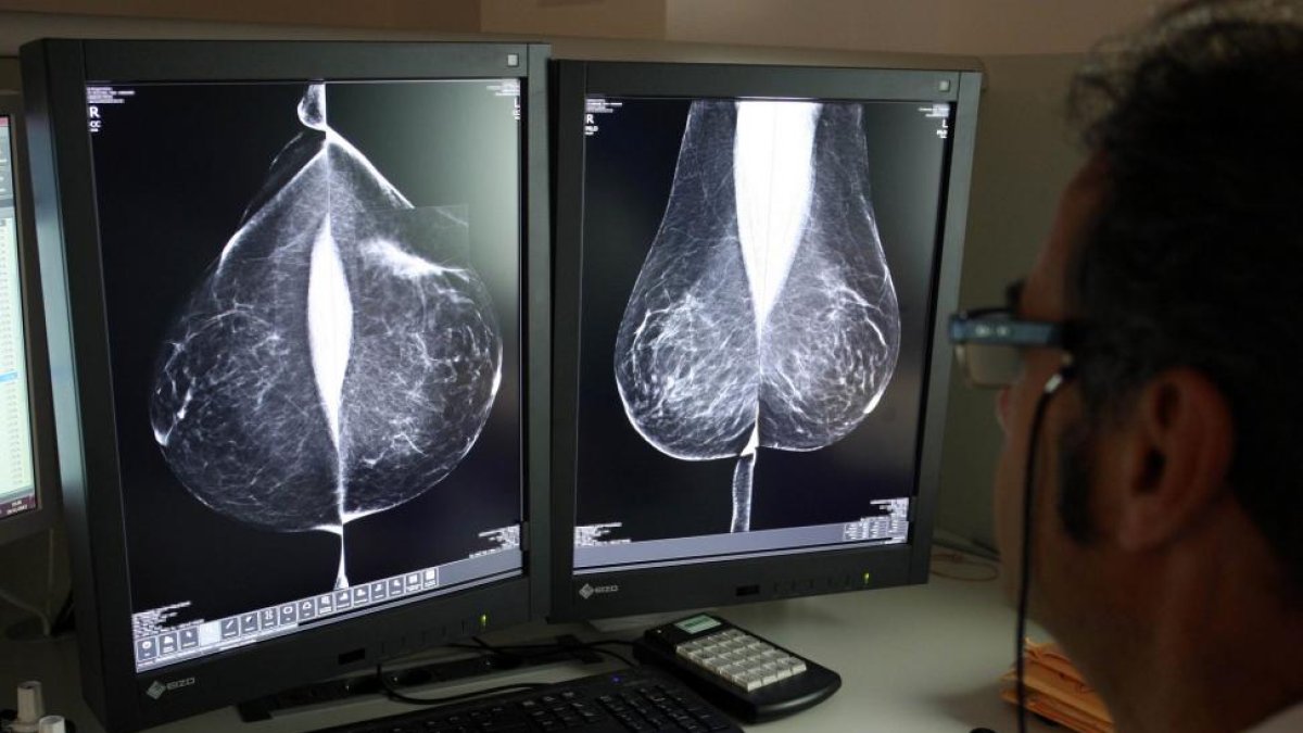Estudio una mamografía digital, en el servicio de mamografías del Hospital Río Hortega de Valladolid.-ICAL