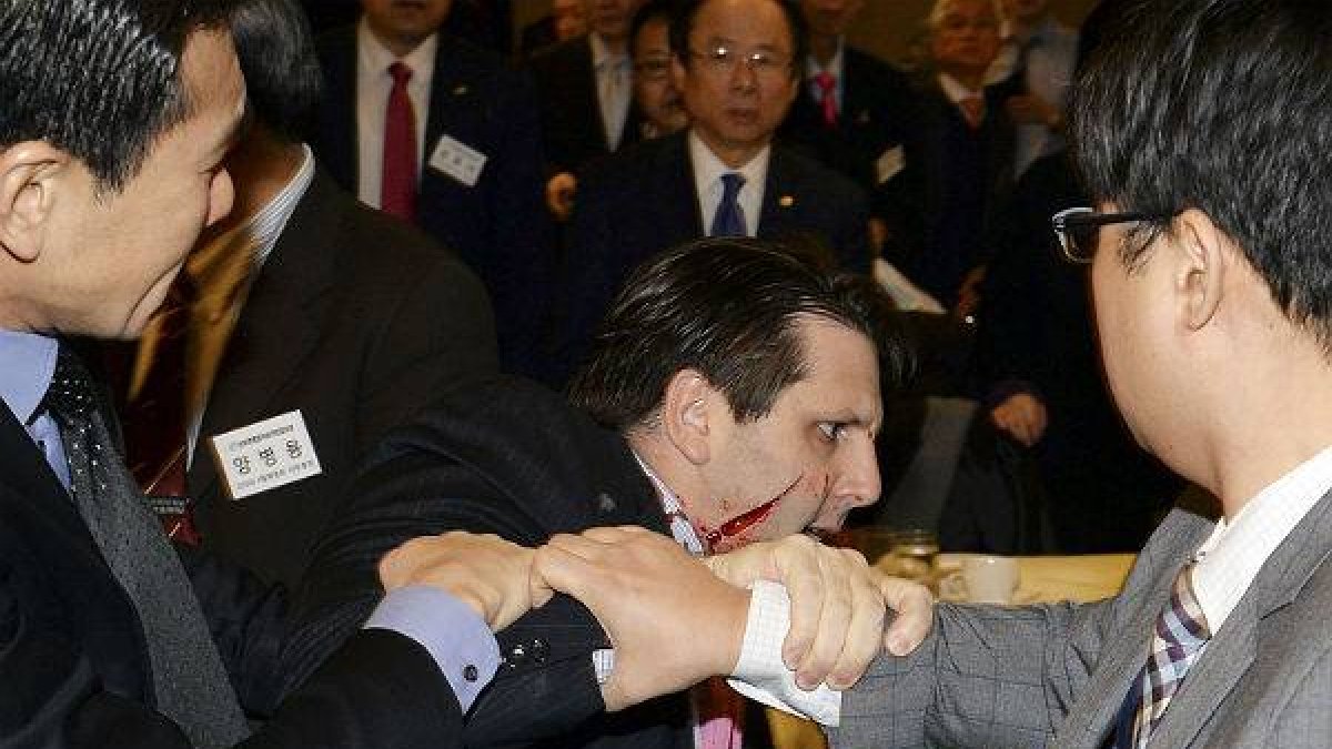 El agresor ha sido detenido tras cortarle con un cuchillo de cocina la cara y una mano.-Foto: REUTERS