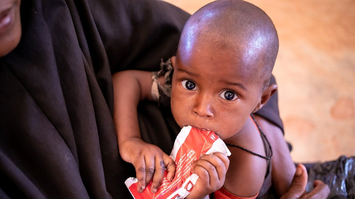 Un niño con un sobre de alimento terapéutico.- E.M.