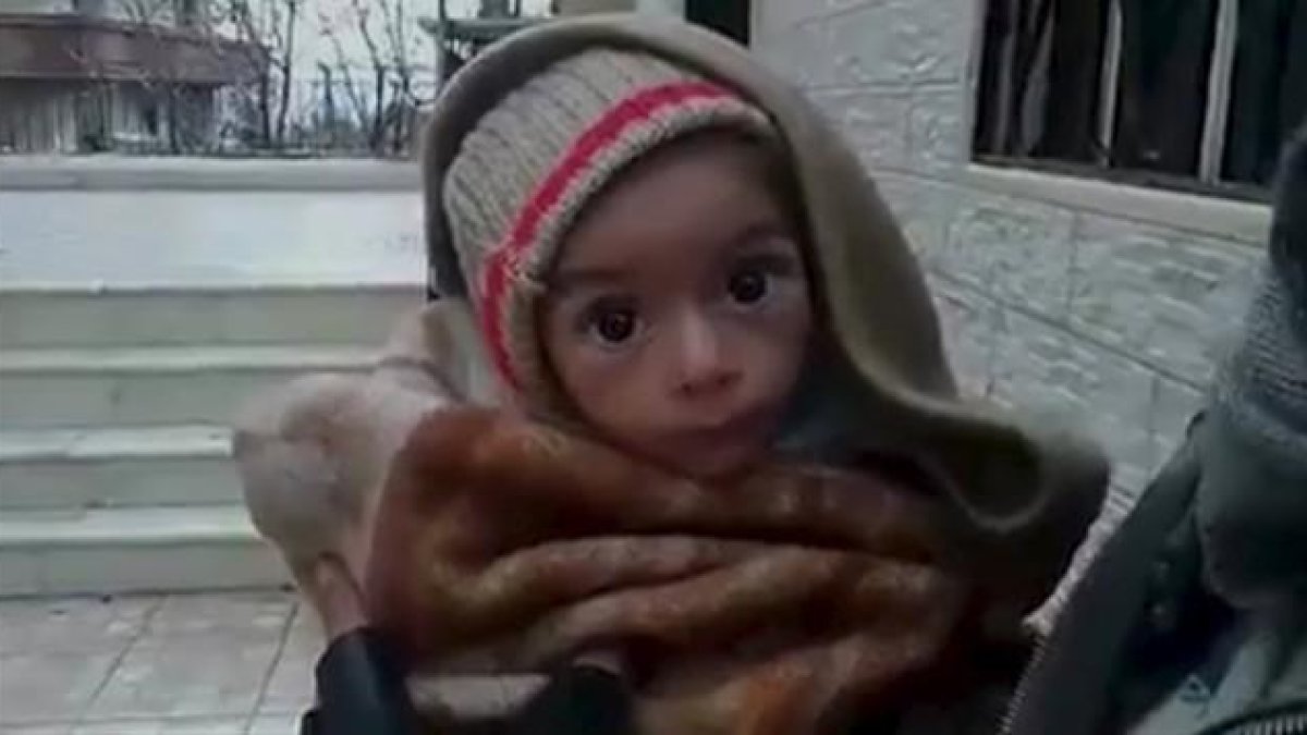 Un bebé desnutrido en Madaya.-REUTERS