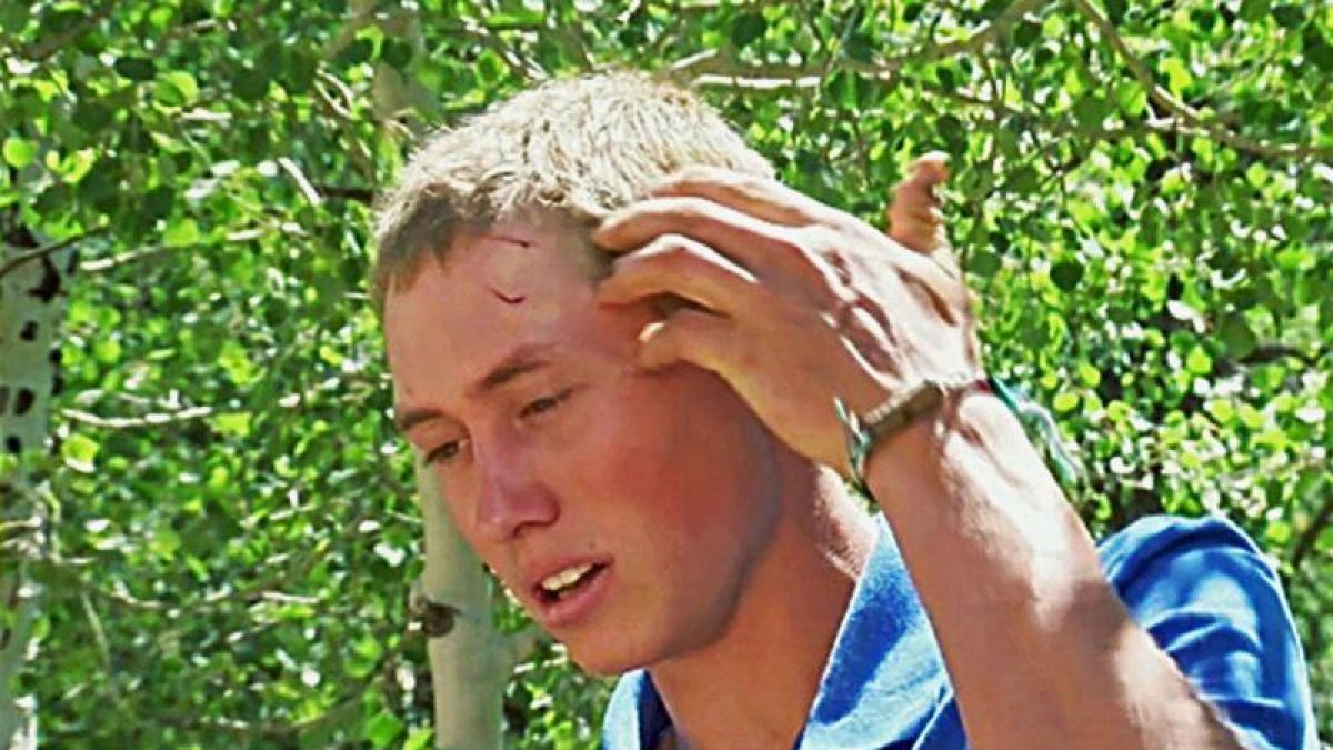 Dylan, el joven de 19 años que ha sobrevivido al ataque de un oso en Colorado (EEUU).-AP