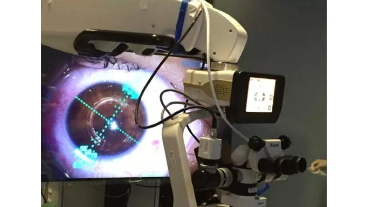 Operación de retina en una imagen de archivo. -E.M.