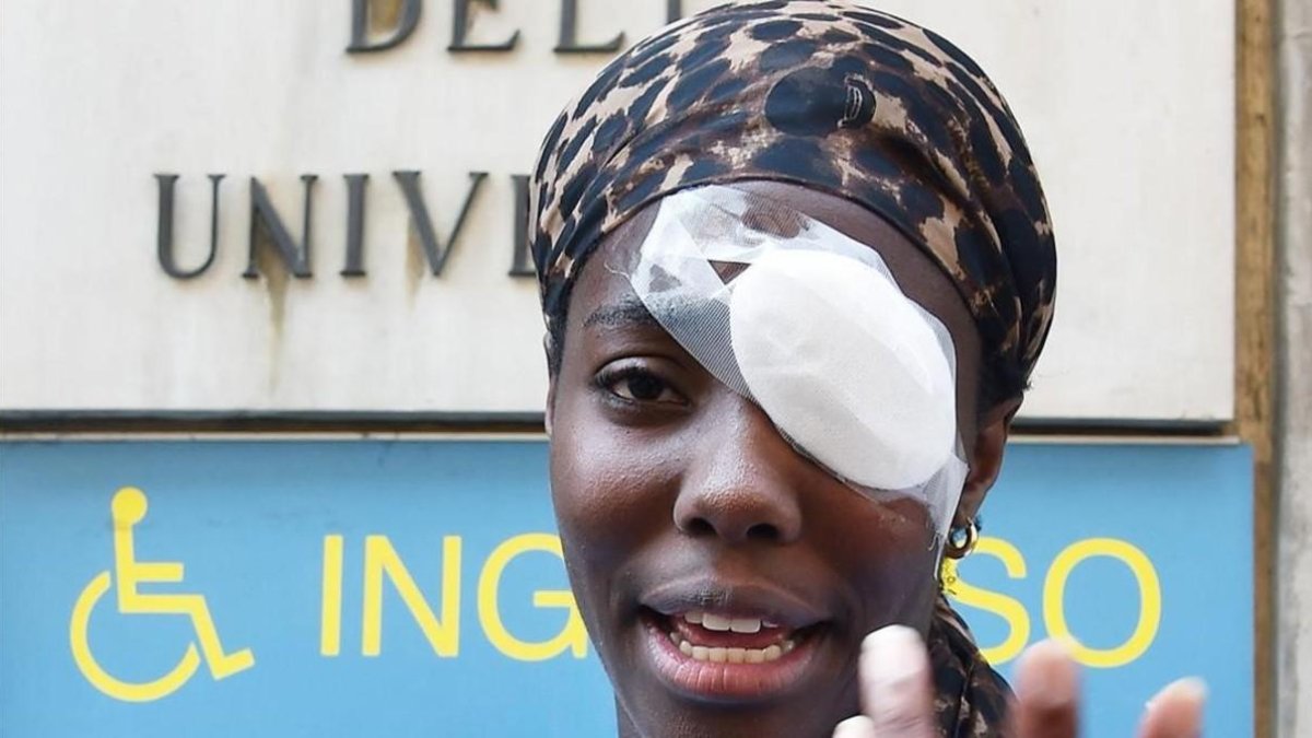 Daisy Osakue con su lesión en la córnea.-AP / ALESSANDRO DI MARCO
