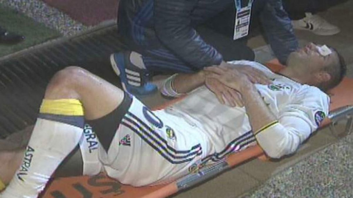Medios turcos afirman que el ojo de Van Persie podría estar en peligro.-