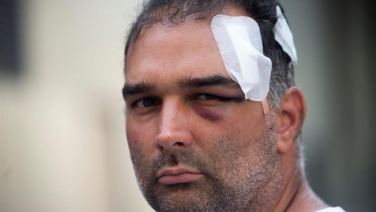 José Bravo, el turista estadounidense de origen cubano que fue agredido el miércoles por un grupo de manteros-QUIQUE GARCIA / EFE