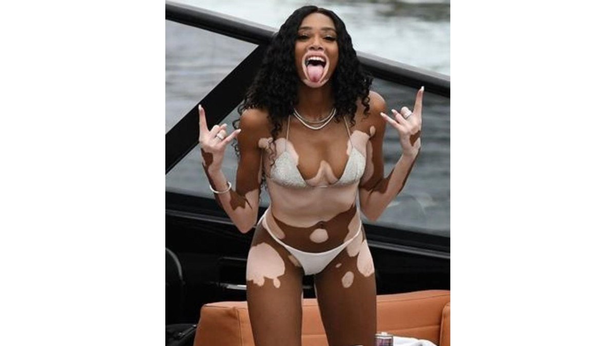 La modelo Winnie Harlow, durante su fiesta de cumpleaños en Miami.-MEGA