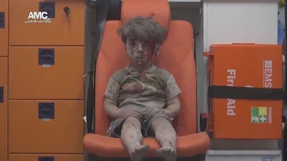 Un niño sirio que sobrevive a un bombardeo aguarda en una ambulancia.-TWITTER