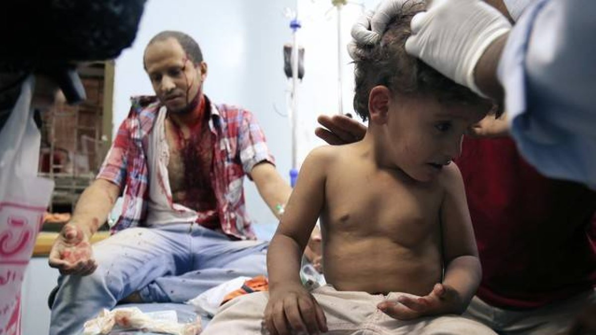 Un niño yemení recibe tratamiento tras resultar heridos en los combates.-AFP / AHMAD AL-BASHA