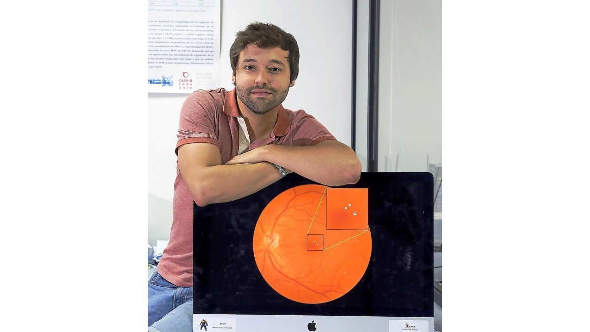 Investigadores vallisoletanos desarrollan un sistema capaz de detectar de forma automática lesiones rojas en la retina-PHOTOGENIC / PABLO REQUEJO