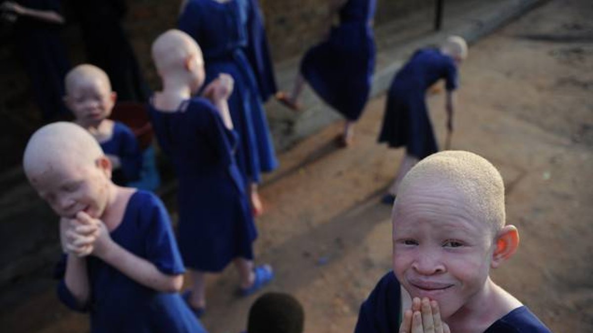 Centro donde se aloja y protege a niños albinos en Tanzania.-Foto: AFP / TONY KARUMBA