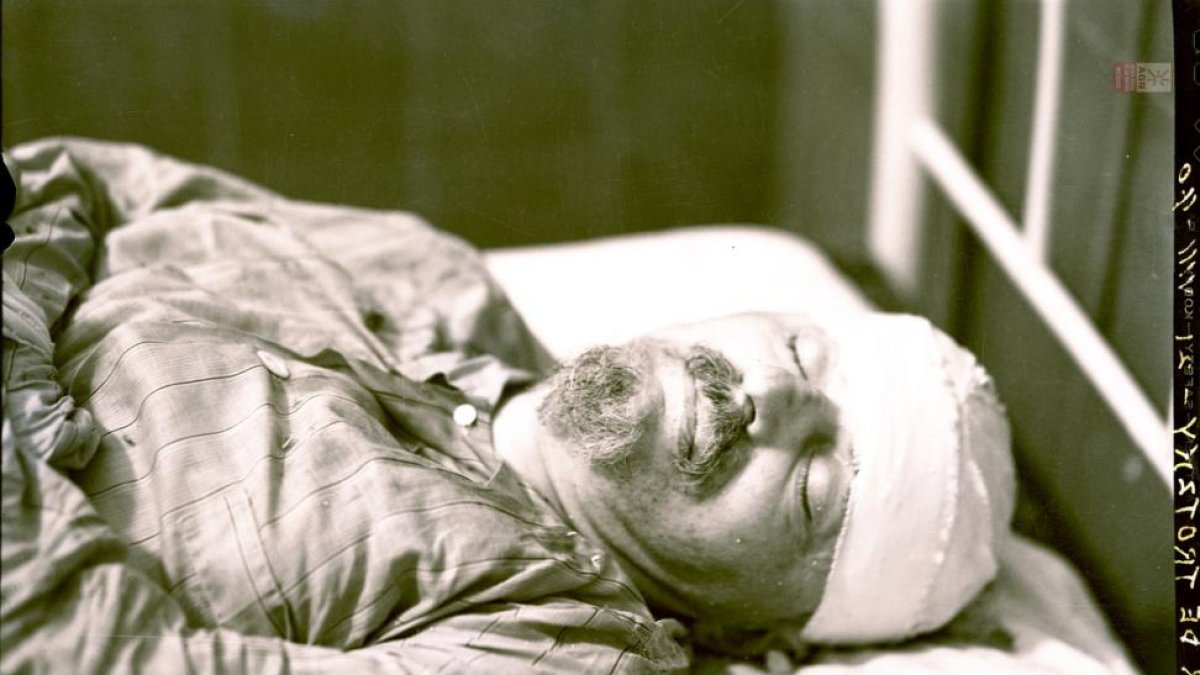Trotsky, en el hospital, tras sufrir el ataque de Ramón Mercader-