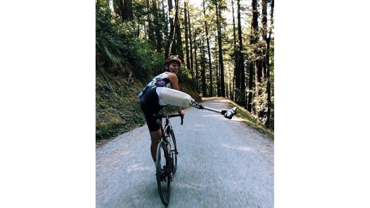 Adrien Costa, enseñando su prótesis-TWITTER