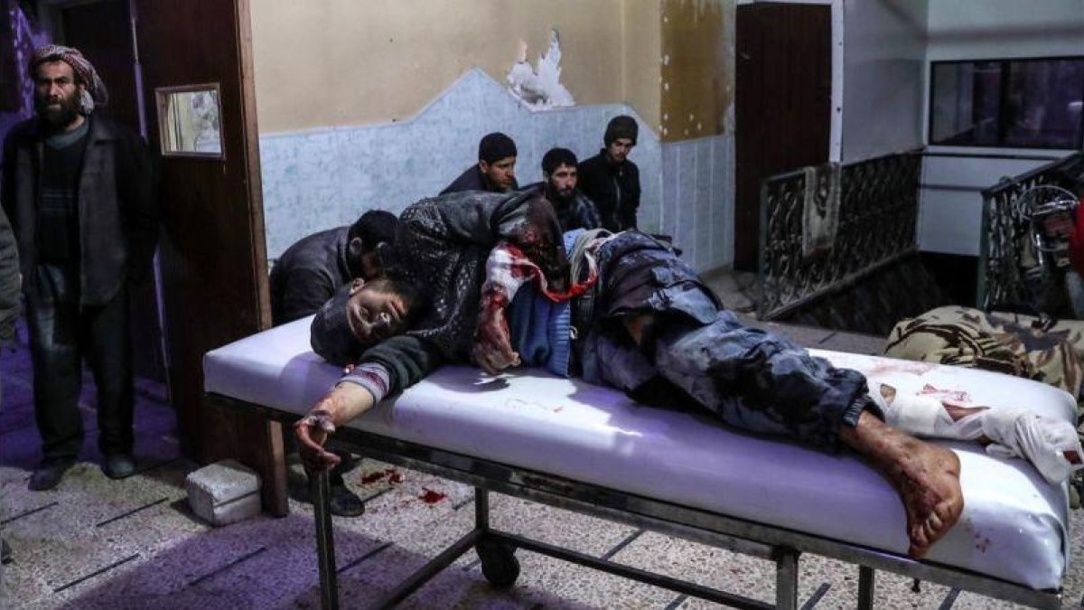 Un herido en un bombardeo en Guta es atendido en un hospital de Duma.-EFE / MOHAMMED BADRA