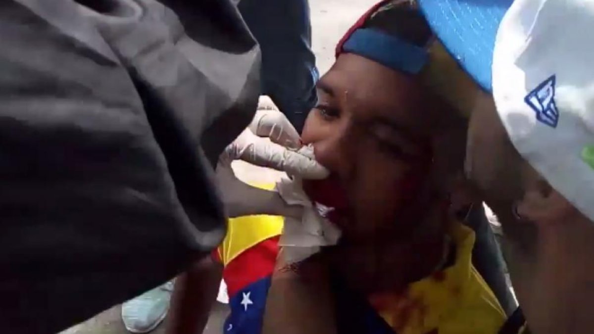 Willy Arteaga, herido.-TWITTER