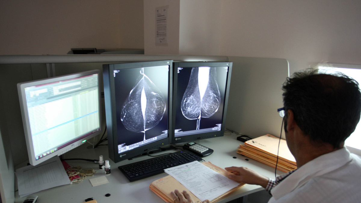 Un radiólogo observa las imágenes tomadas por el mamógrafo en el Hospital Río Hortega de Valladolid.