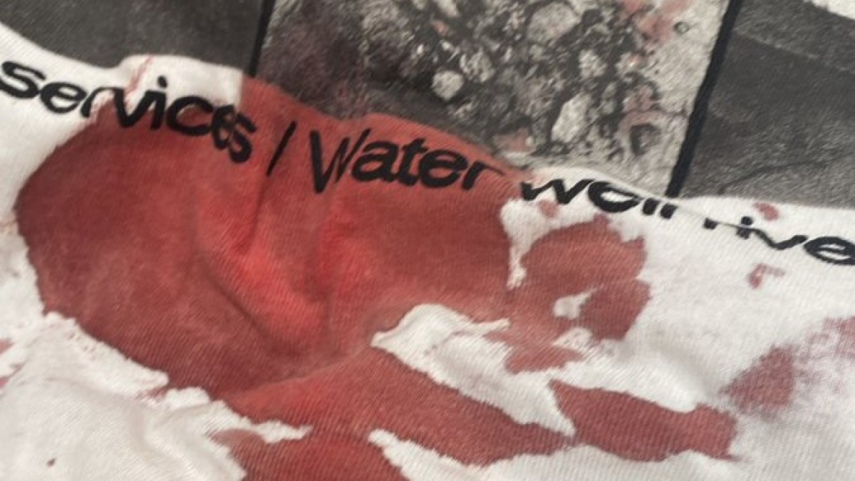 Imagen de la camiseta del hijo de la exprocuradora de Cs Marta Sanz tras ser agredido.